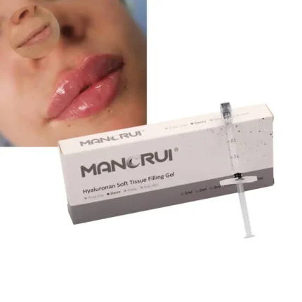 Derm 1ml Lip Filler, Slight lip plumping effect.., for Frown Line and Marionette Line, Sad Smile lines