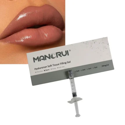 Derm 2ml Lip Filler, Normal lip plumping effect., for Frown Line and Marionette Line, Sad Smile lines（Certified by CE and FDA.）